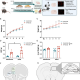 Age-dependent and region-specific alteration of parvalbumin neurons, perineuronal nets and microglia in the mouse PFC and hippocampus following obesogenic diet consumption